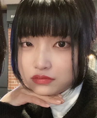 [眼睛] 짱녕 - 切開式眼瞼下垂矯正 重修手術