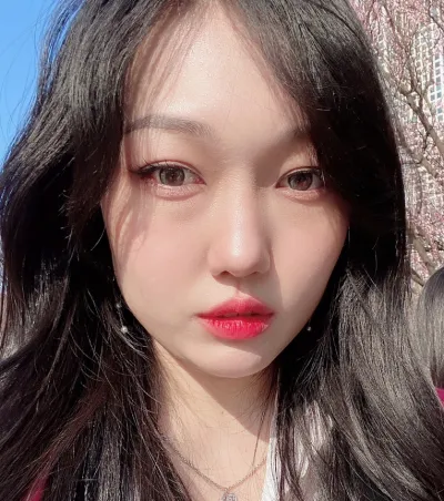 [眼部] 莎莉 - 眼下脂肪重新配置