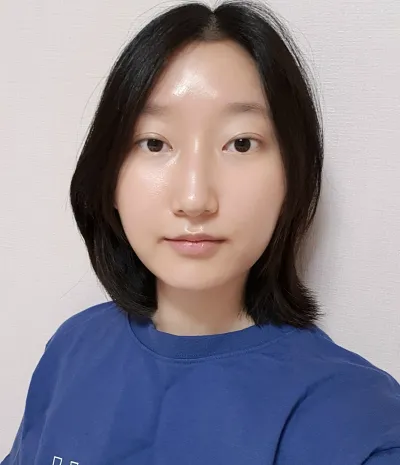 [眼睛] 雞蛋捲 - 切開式眼瞼下垂矯正重修手術，下眼瞼下至