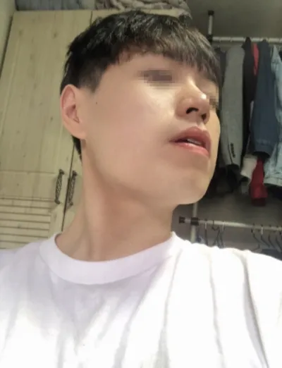 [顏面輪廓] COZ802 - 下顎角、下巴、鼻樑