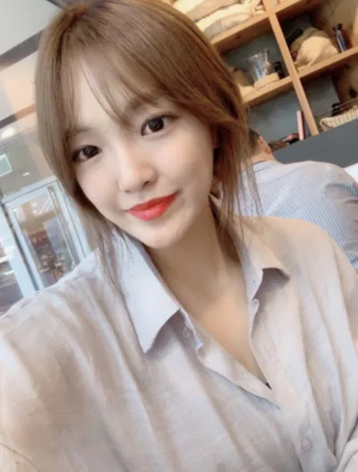 [眼部]整形後記 - 眼型矯正