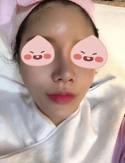 [皮膚] 王八 - 音波拉提