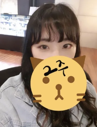 [眼部] shshin7 - 下眼瞼下至、後眼角切開