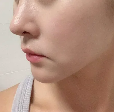 [微整] kiya ho1115 - 提拉