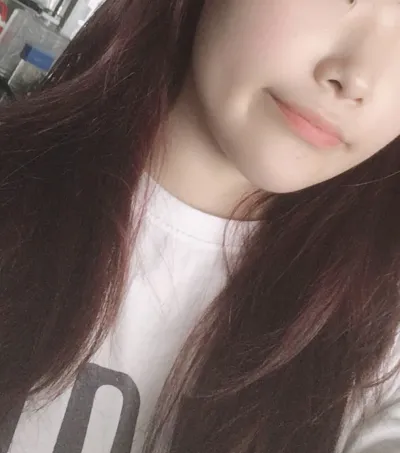 [微整形] Bongbing - 玻尿酸填充