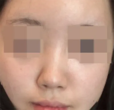 [鼻] 昂잉웅엉앙 - 鼻