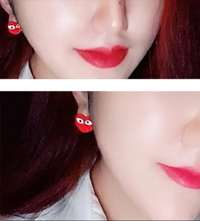 [微整形] Alrokdalrok Milk - 填充劑、肉毒桿菌、輪廓針