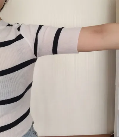 [抽脂] 加嚕 - 抽脂