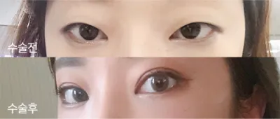 [眼睛] 恩美咖美 - 眼睛