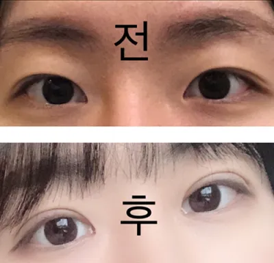 [眼睛] 羊羹SOPU - 眼睛