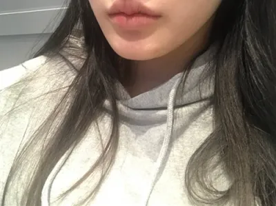 [微整形] yghvj - 填充劑