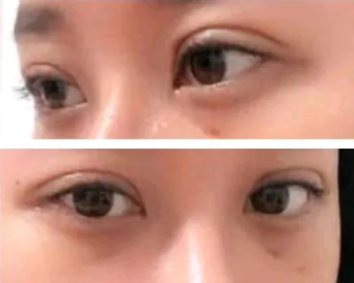 [眼部] Romantic Tree - 眼部