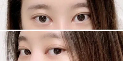 [眼睛] Doochi - 眼睛