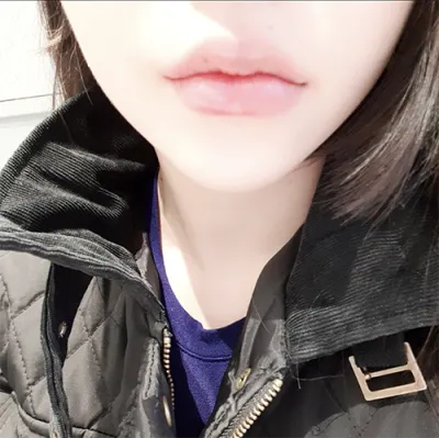 [微整形] *99* - 嘴唇