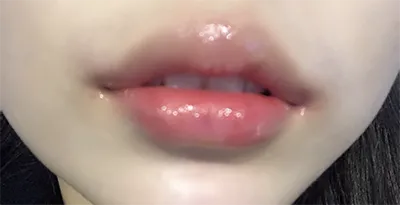 [微整] lol - 嘴唇