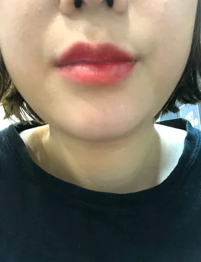 [微整] 魔法公主 - 豐唇