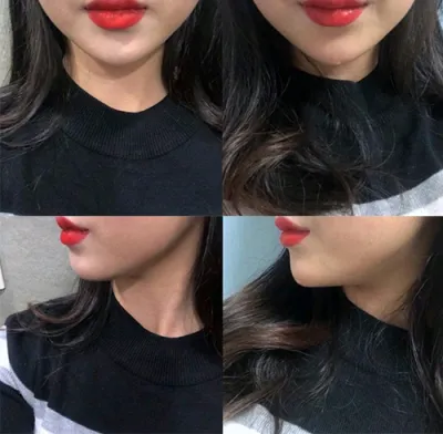 [微整] 꼼꼼 - 下巴填充、頦肌肉毒桿菌