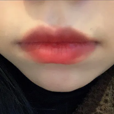 [微整形] 順둥이 - 嘴唇