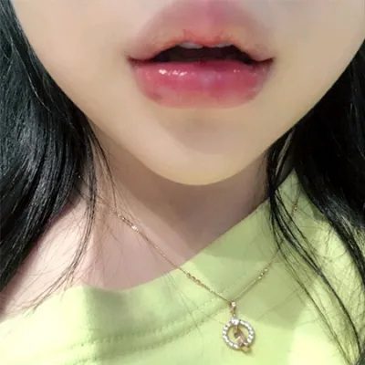 [微整形] Bean 1234 - 豐唇玻尿酸