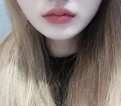 [微整形] Po Chu - 嘴唇