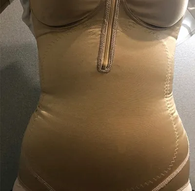 [抽脂] 像星星一樣飛舞吧 - 腹部、小腿抽脂