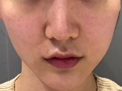 [皮膚] nomango - 毛孔