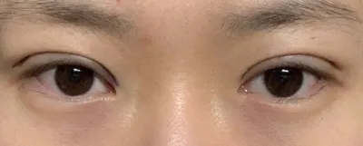 [眼睛] 咕嚕嚕 - 眼睛