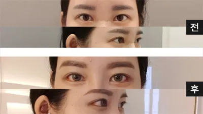 [眼部]尼뀨伊 - 眼部