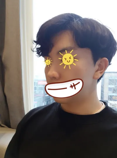 [微整形] Ki Ri Ri Ri - 鼻翼肉毒桿菌