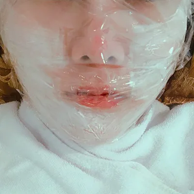 [微整] yj1221 - 拉提