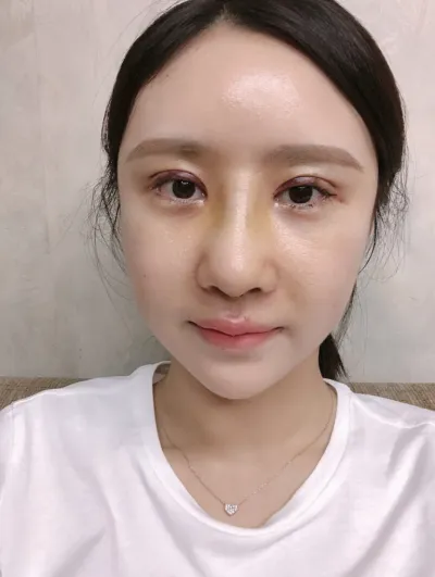 [鼻] 제뉘블리 - 眼、鼻