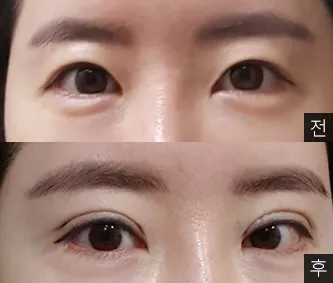 [眼睛] yahoooo - 眼睛