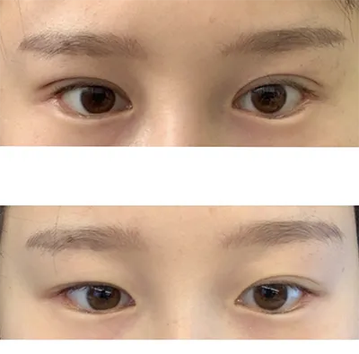 [眼部] 鮪魚美乃滋 - 眼部