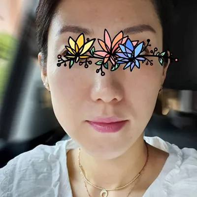 [鼻] 總總總順伊 - 鼻雕塑注射, 鼻翼肉毒桿菌