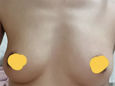 [胸部] 喜잇 - 胸部