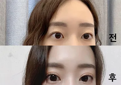 [眼睛] ski03078 - 眼睛