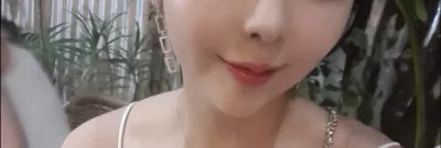 [微整形] 꾸꾸루루 - 嘴唇填充、埋線拉提