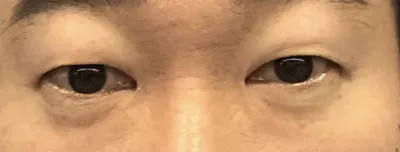 [眼睛] Buddada - 眼睛