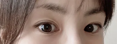 [眼睛] ㅈㅎㅊ - 眼睛