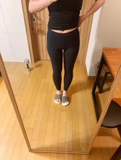 [抽脂] asura87 - 全身抽脂