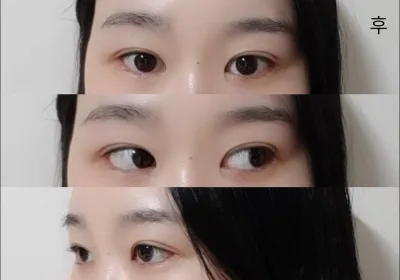 [眼睛] 기솝 - 眼睛