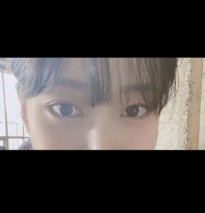 [眼部] yong0423 - 開後眼角, 開下眼角