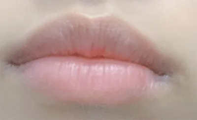 [微整形] 곰탕푸우 - 嘴唇