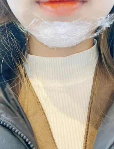 [微整形] 告別戽斗 - 下巴填充、肉毒桿菌