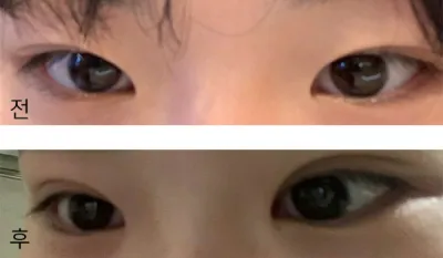 [眼睛] 쵸키1234 - 眼睛