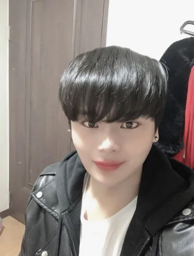 [眼睛] 玄京煥 - 下眼瞼下至, 後眼角切開