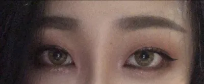 [眼睛] High High Neung - 下眼瞼下至, 後眼角切開