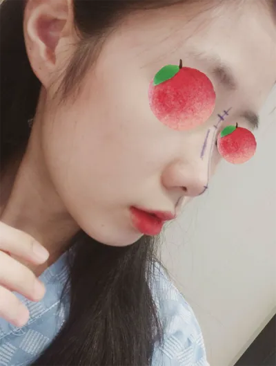 [鼻] Dudu Smoothie - 鼻