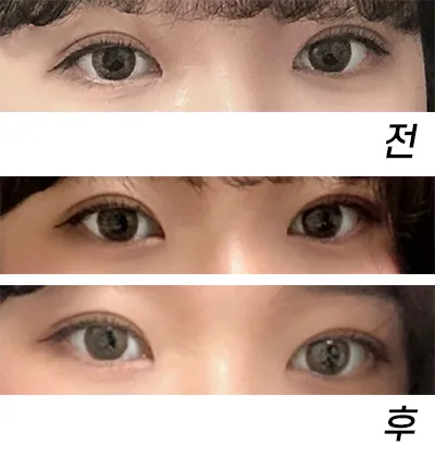 [眼睛] qhrehd - 眼睛