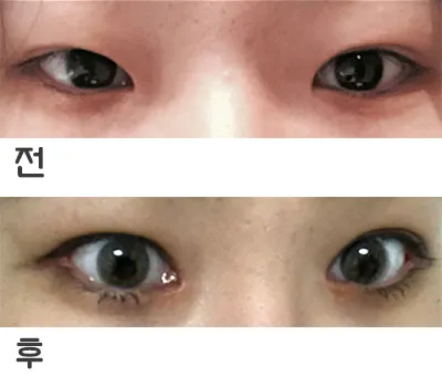 [眼睛] jdnendndj - 眼睛